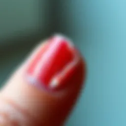 Close-up of a nail with peeling polish